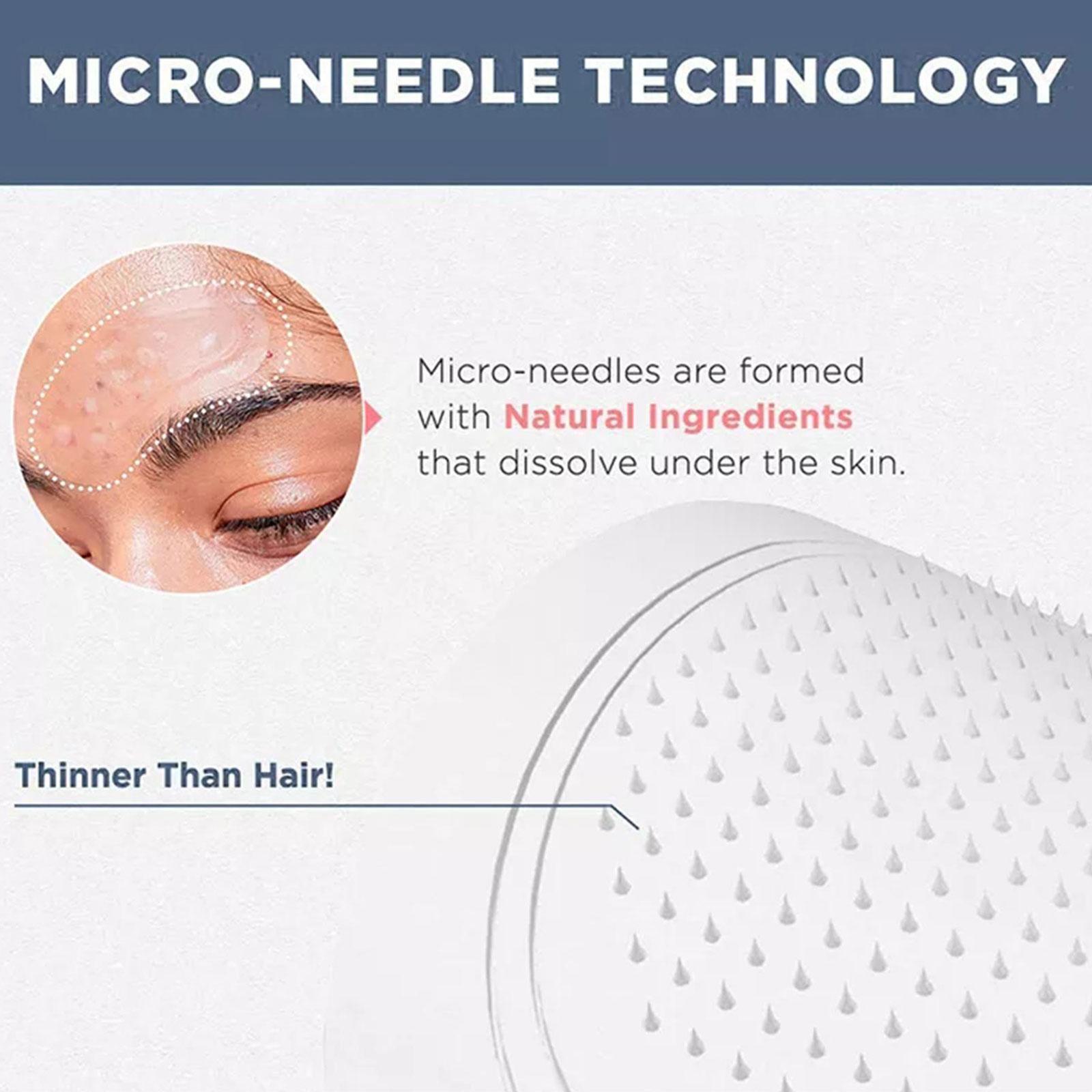 0.2mm Micro-needle Eye Patch M - Collagen Eye Patch review and price