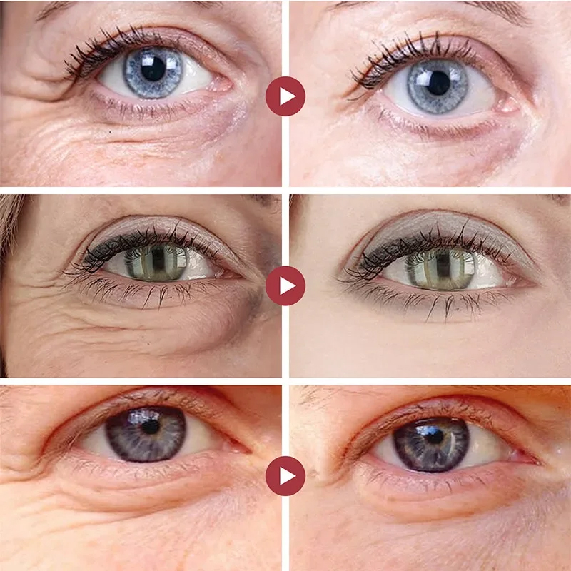 Wrinkle Remove Eyes Patches Fi - Collagen Eye Patch review and price